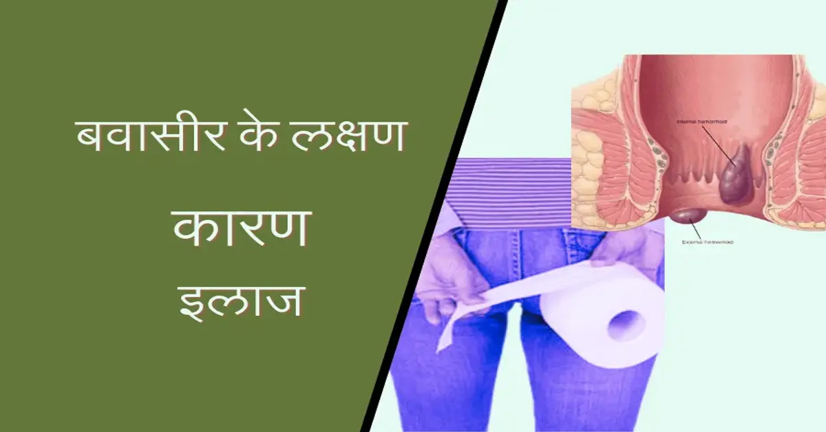 Read more about the article बवासीर के लक्षण, कारण और 3 रामबाण आयुर्वेदिक घरेलू उपाय
